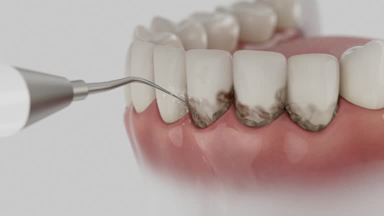 Reliable Root Canal Treatment contractor in Summit County County, OH by Dentist Open Now